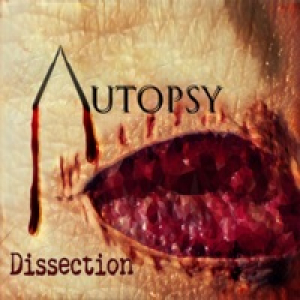 Dissection - Single